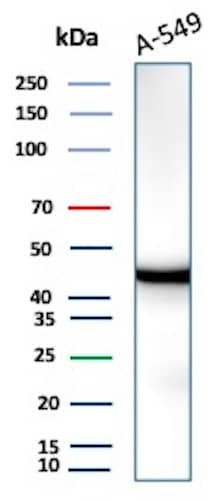 Isocitrate Dehydrogenase 1/IDH1 Antibody (IDH1/1152) Western Blot: Isocitrate Dehydrogenase 1/IDH1 Antibody (IDH1/1152) [NBP2-45156] -