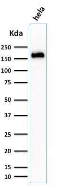 Podocalyxin Like Antibody (3D3) - IHC-Prediluted Western Blot: Podocalyxin Like Antibody (3D3) - IHC-Prediluted [NBP2-45167] -