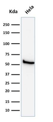 Mitochondria Antibody (113-1) - IHC-Prediluted Western Blot: Mitochondria Antibody (113-1) - IHC-Prediluted [NBP2-45195] -