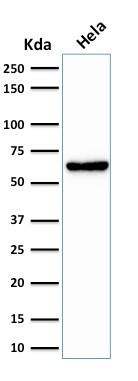 Mitochondria Antibody (SPM198) - IHC-Prediluted Western Blot: Mitochondria Antibody (SPM198) - IHC-Prediluted [NBP2-45204] -