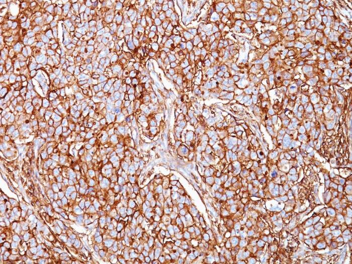 CD44 Antibody (SPM521) Immunohistochemistry-Paraffin: CD44 Antibody (SPM521) [NBP2-45255] -
