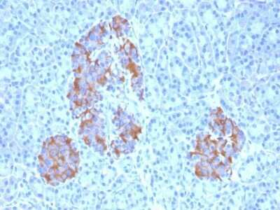 TNF-alpha Antibody (TNFA/1172)