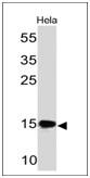 SUMO2/3 Antibody (SM23/496) - IHC-Prediluted Western Blot: SUMO2/3 Antibody (SM23/496) - IHC-Prediluted [NBP2-45335] -