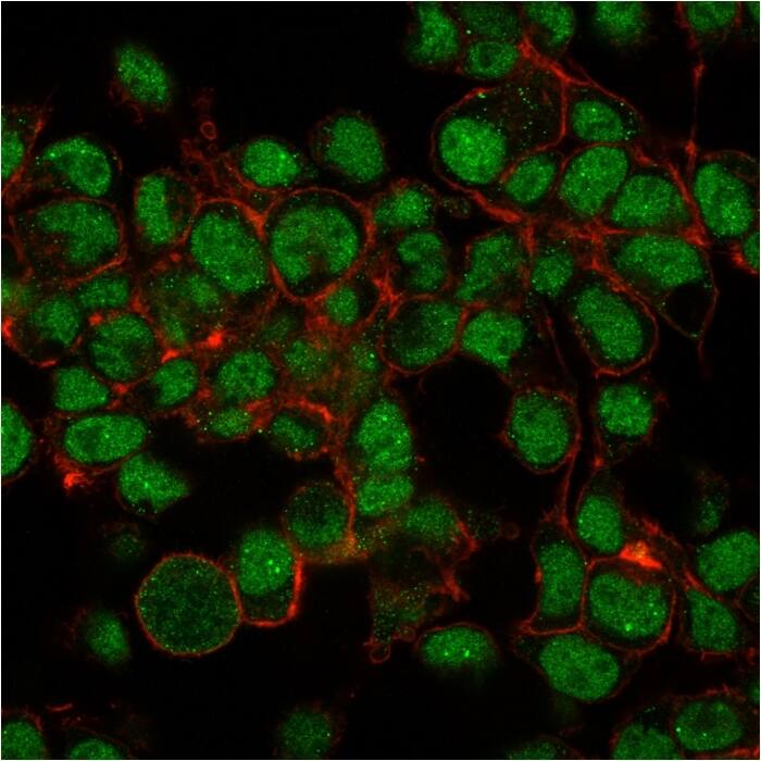SUMO1 Antibody (SM1/495) - IHC-Prediluted Immunocytochemistry/ Immunofluorescence: SUMO1 Antibody (SM1/495) - IHC-Prediluted [NBP2-45337] -