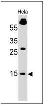 SUMO1 Antibody (SM1/495) - IHC-Prediluted Western Blot: SUMO1 Antibody (SM1/495) - IHC-Prediluted [NBP2-45337] -