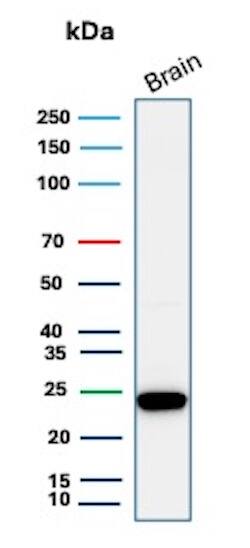 UCH-L1/PGP9.5 Antibody (31A3) - IHC-Prediluted Western Blot: UCH-L1/PGP9.5 Antibody (31A3) - IHC-Prediluted [NBP2-45339] -