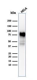 CD44 Antibody (SPM544) - IHC-Prediluted Western Blot: CD44 Antibody (SPM544) - IHC-Prediluted [NBP2-45347] -