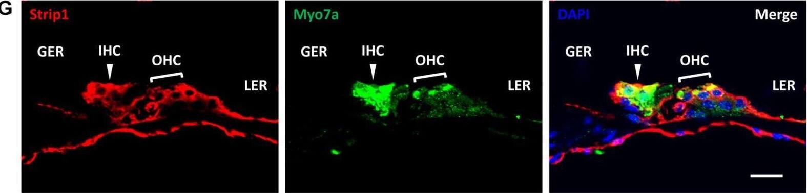 STRIP1 Antibody (OTI7B8)