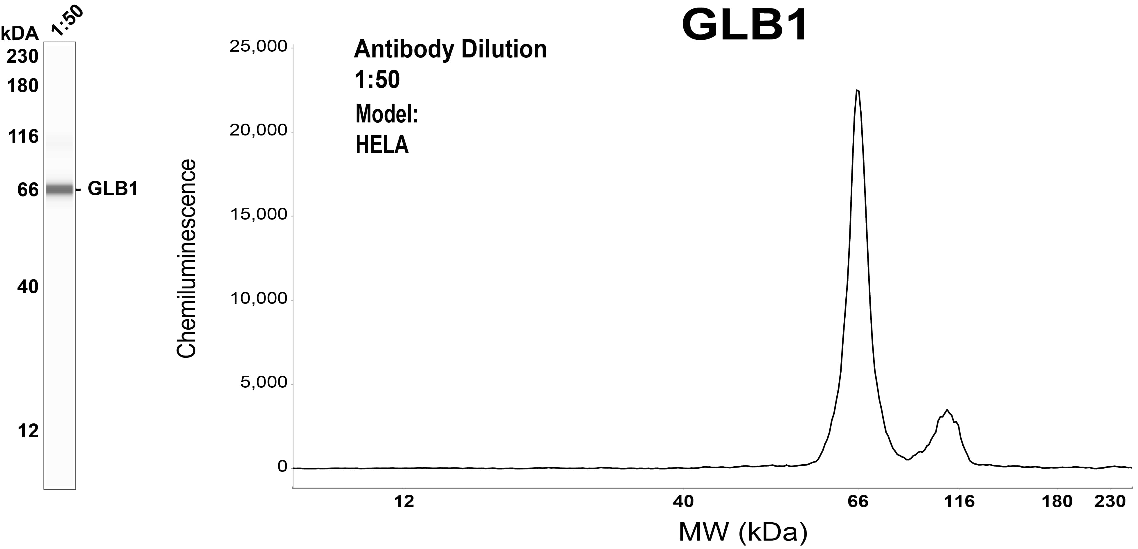 beta-Galactosidase-1/GLB1 Antibody (OTI1C9)