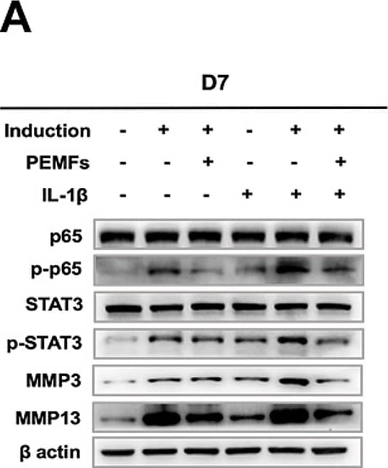 MMP-13 Antibody (OTI2D8)