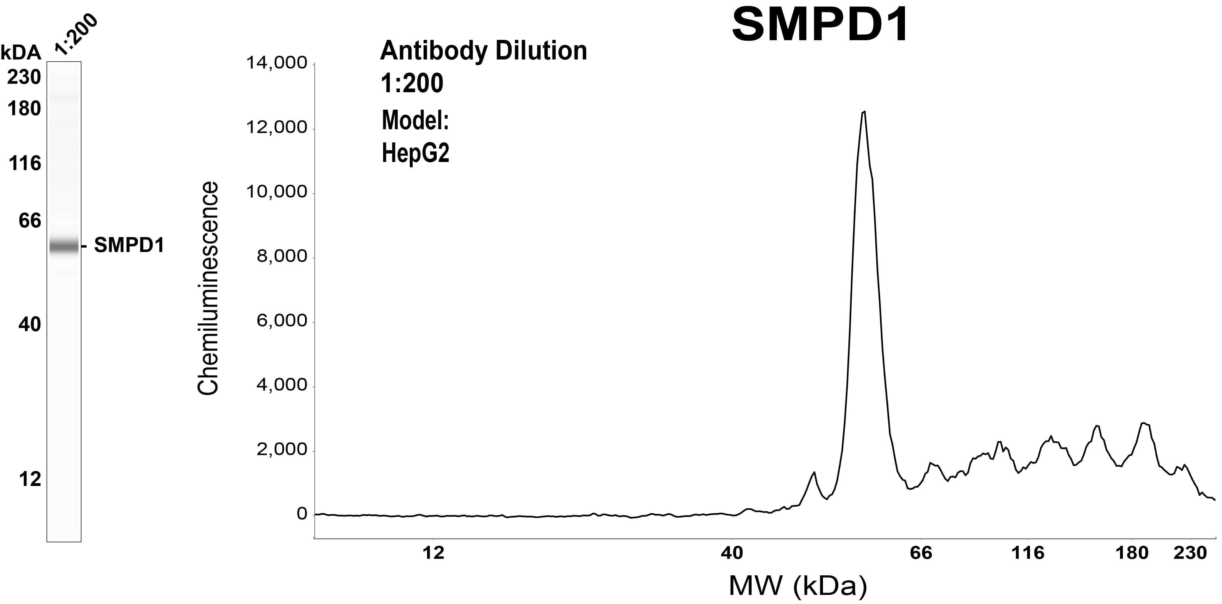 SMPD1 Antibody (OTI3H7)