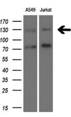 TSC1 Antibody (OTI3A2)