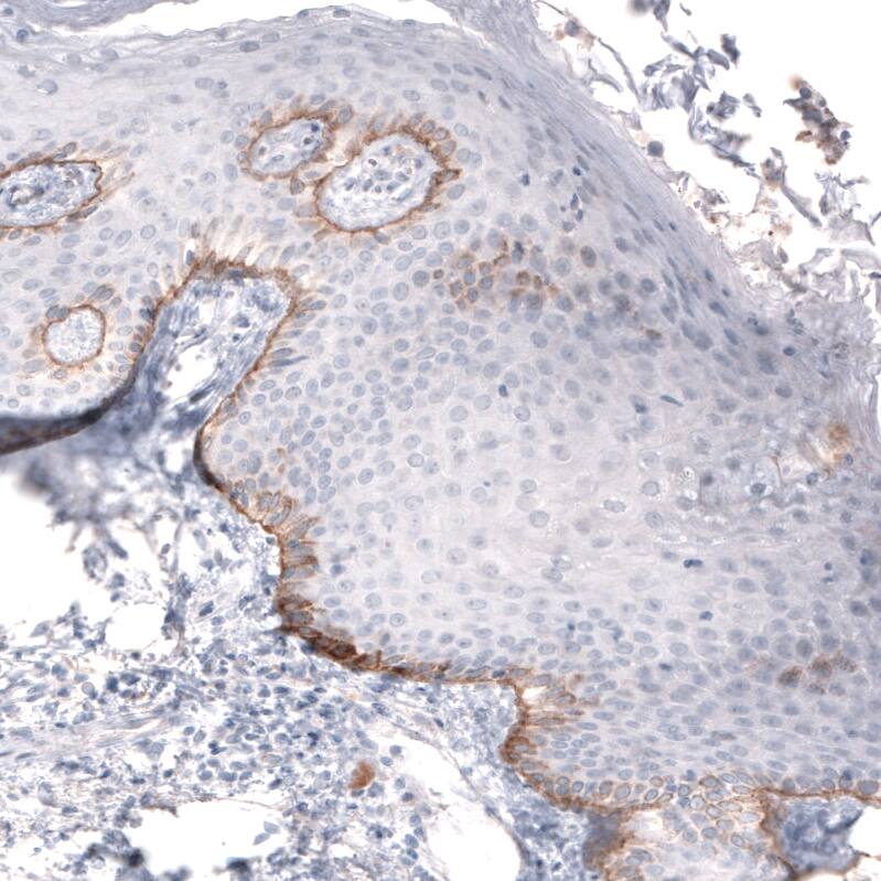 Laminin beta 3 Antibody (CL3353) - BSA Free Immunohistochemistry-Paraffin: Laminin beta 3 Antibody (CL3353) [NBP2-46622]