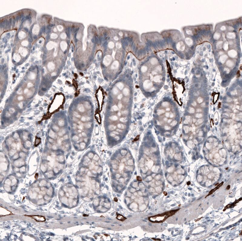 Laminin beta 3 Antibody (CL3353) - BSA Free Immunohistochemistry-Paraffin: Laminin beta 3 Antibody (CL3353) [NBP2-46622]