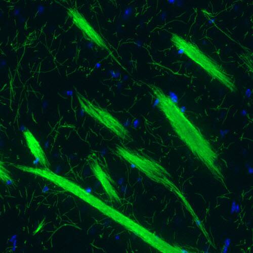 MBP Antibody (CL2819) - BSA Free Immunohistochemistry-Paraffin: MBP Antibody (CL2819) [NBP2-46630]