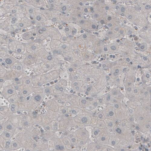 MOG Antibody (CL2852) - BSA Free Immunohistochemistry: MOG Antibody (CL2852) [NBP3-52462]