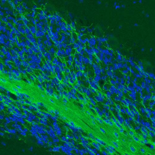 MOG Antibody (CL2852) - BSA Free Immunohistochemistry: MOG Antibody (CL2852) [NBP3-52462]