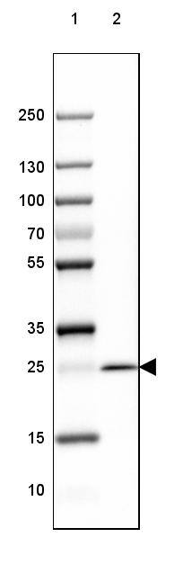 MOG Antibody (CL2852) - BSA Free Western Blot: MOG Antibody (CL2852) [NBP3-52462]