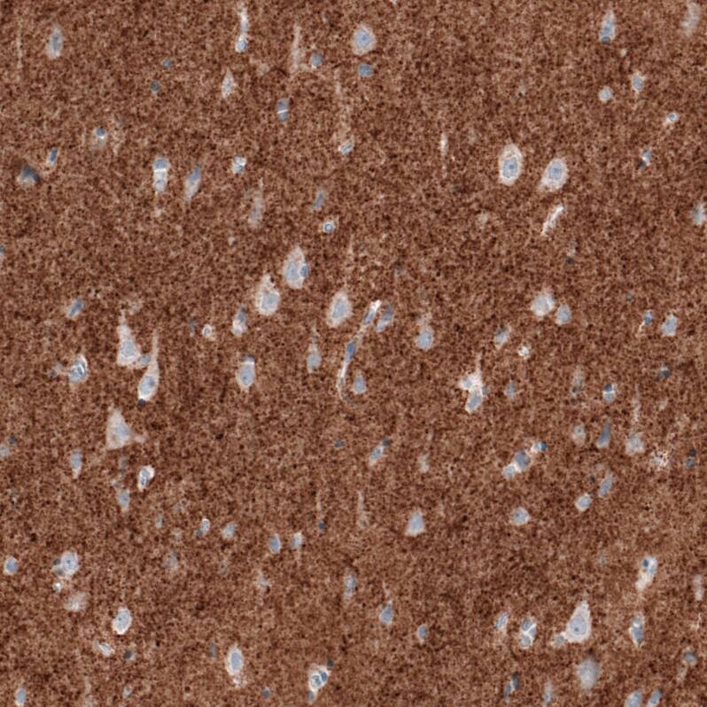 VGLUT2 Antibody (CL2921) - BSA Free Immunohistochemistry: VGLUT2 Antibody (CL2921) [NBP3-52463]