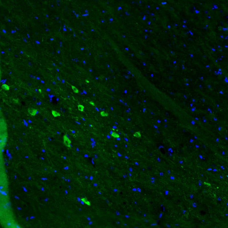 Dopa Decarboxylase/DDC Antibody (CL2962) - BSA Free Immunohistochemistry: Dopa Decarboxylase/DDC Antibody (CL2962) [NBP3-52464]