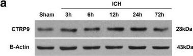CTRP9/C1qTNF9 Antibody