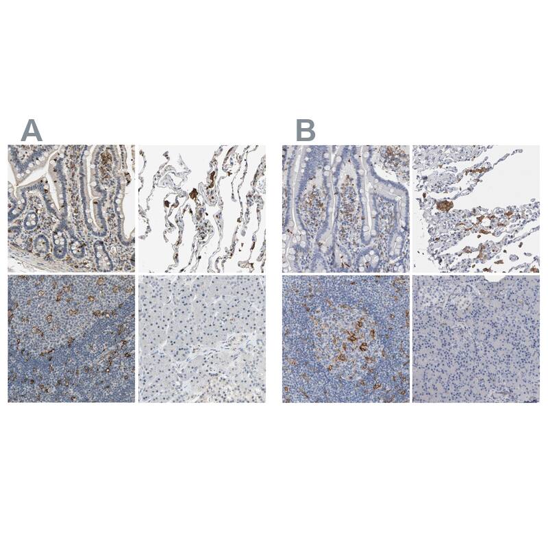 SCAP2 Antibody Immunohistochemistry-Paraffin: SCAP2 Antibody Antibody [NBP2-47288]