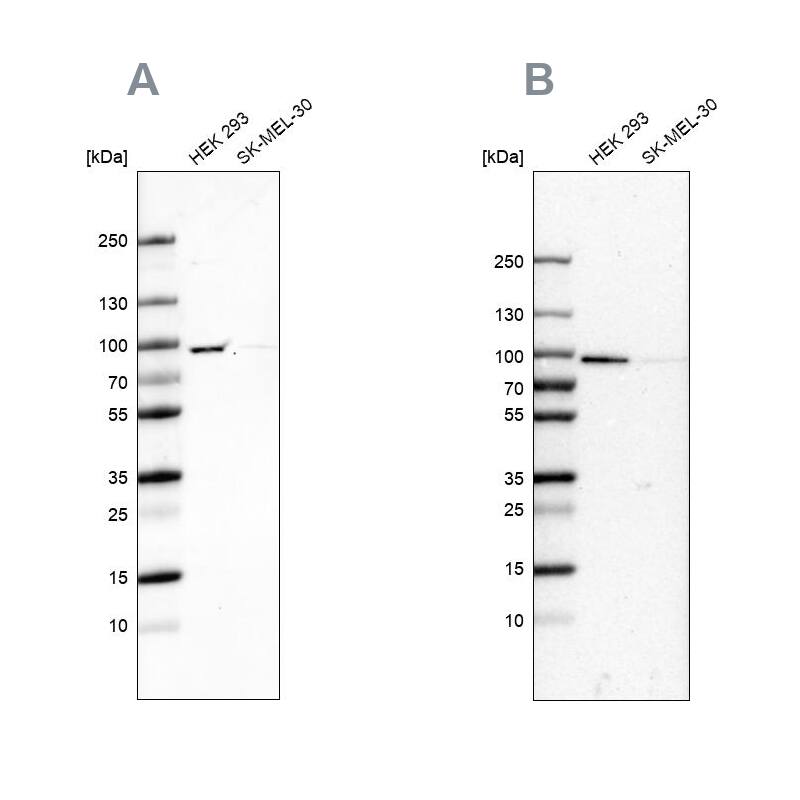 RAVER1 Antibody Western Blot: RAVER1 Antibody Antibody [NBP2-47313]