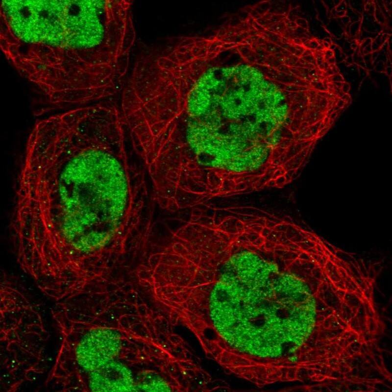 RAVER1 Antibody Immunocytochemistry/Immunofluorescence: RAVER1 Antibody [NBP2-47313]