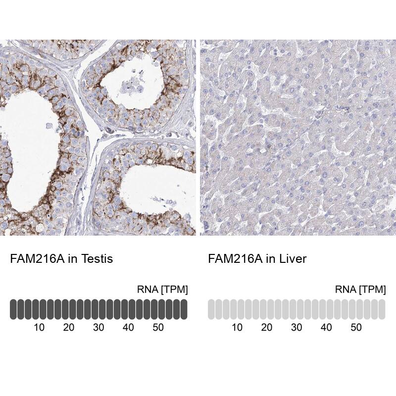 HSU79274 Antibody - BSA Free Immunohistochemistry-Paraffin: HSU79274 Antibody [NBP2-47425]