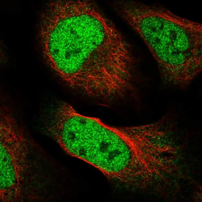FAM59A Antibody - BSA Free Immunocytochemistry/ Immunofluorescence: FAM59A Antibody [NBP2-47460]