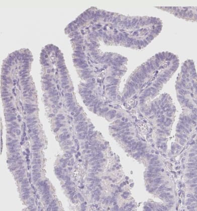 delta 2 Catenin Antibody - BSA Free
