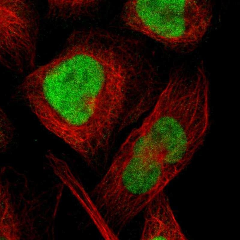 CXorf67 Antibody - BSA Free Immunocytochemistry/ Immunofluorescence: CXorf67 Antibody [NBP2-47499]