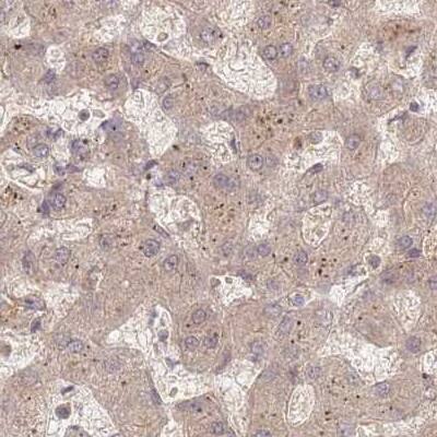 26S proteasome subunit 9 Antibody