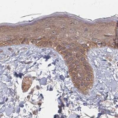 26S proteasome subunit 9 Antibody