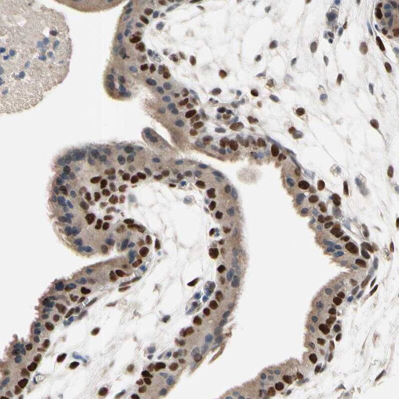ZKSCAN3 Antibody - BSA Free Immunohistochemistry: ZKSCAN3 Antibody - BSA Free [NBP2-47570]