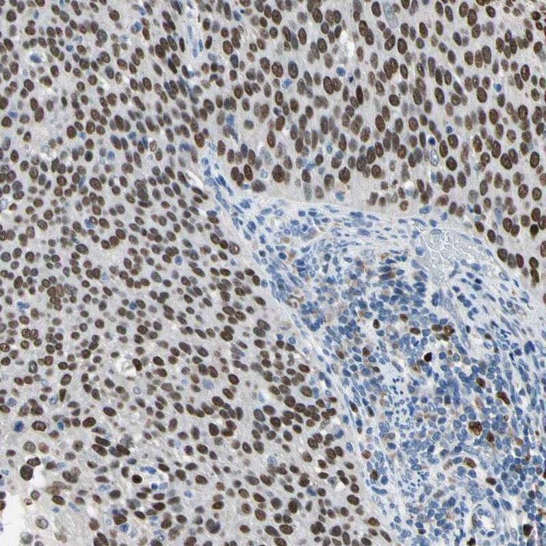 ZKSCAN3 Antibody - BSA Free Immunohistochemistry: ZKSCAN3 Antibody - BSA Free [NBP2-47570]