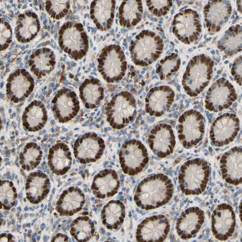 ZKSCAN3 Antibody - BSA Free Immunohistochemistry: ZKSCAN3 Antibody - BSA Free [NBP2-47570]