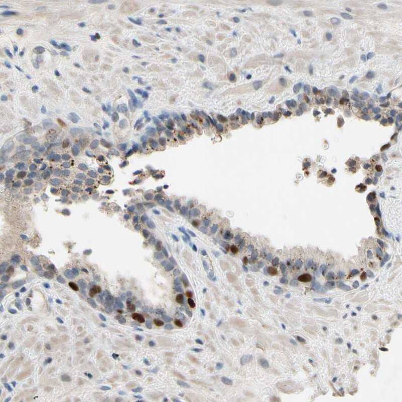 ZKSCAN3 Antibody - BSA Free Immunohistochemistry: ZKSCAN3 Antibody - BSA Free [NBP2-47570]