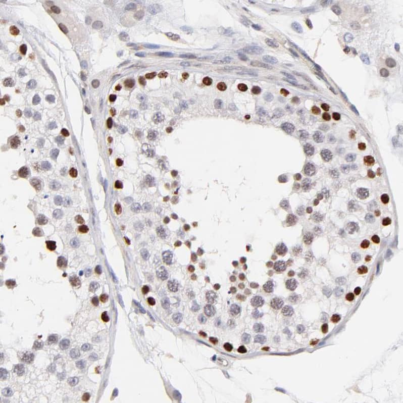ZFP92 Antibody - BSA Free Immunohistochemistry-Paraffin: ZFP92 Antibody [NBP2-47573]
