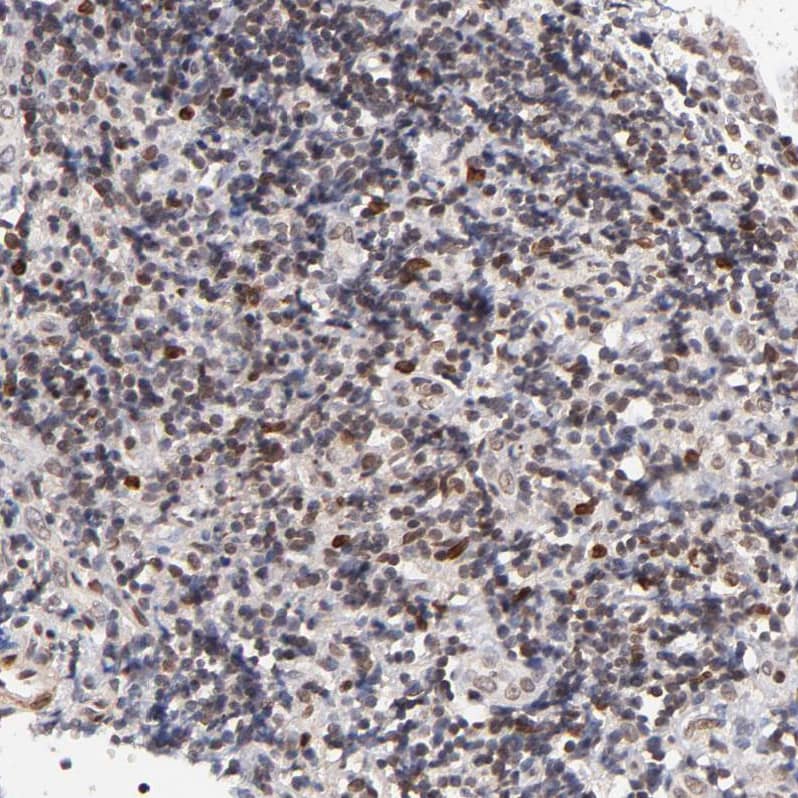 ZFP92 Antibody - BSA Free Immunohistochemistry-Paraffin: ZFP92 Antibody [NBP2-47573]