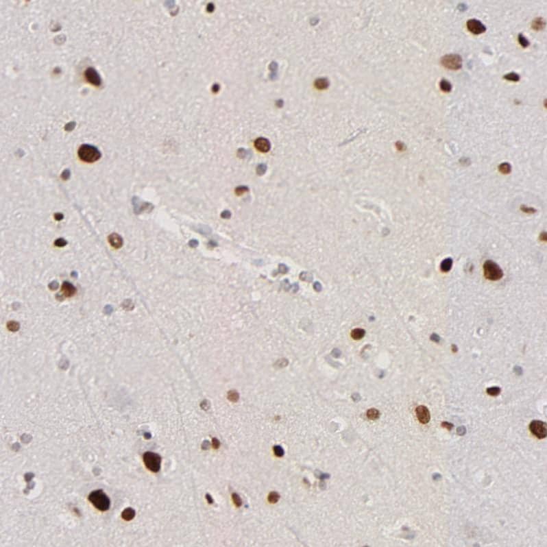 ZFP92 Antibody - BSA Free Immunohistochemistry-Paraffin: ZFP92 Antibody [NBP2-47573]