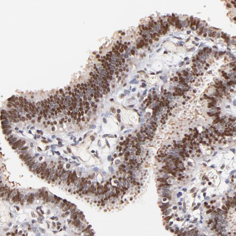 ZFP92 Antibody - BSA Free Immunohistochemistry-Paraffin: ZFP92 Antibody [NBP2-47573]