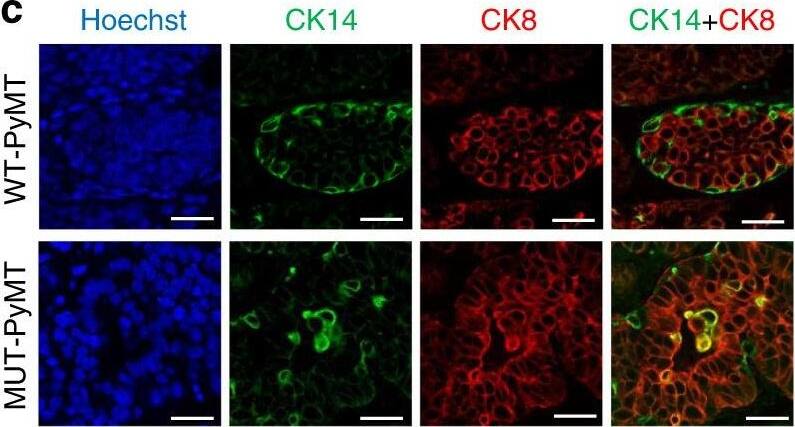 Cytokeratin 14 Antibody (KRT14/532) [Alexa Fluor® 647]