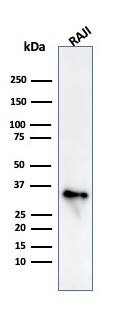 CD74 Antibody (CLIP/813) - IHC-Prediluted Western Blot: CD74 Antibody (CLIP/813) - IHC-Prediluted [NBP2-48026] -