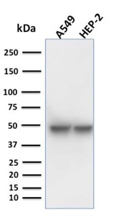 Cytokeratin 18 Antibody (KRT18/1190) - IHC-Prediluted Western Blot: Cytokeratin 18 Antibody (KRT18/1190) - IHC-Prediluted [NBP2-48048] -