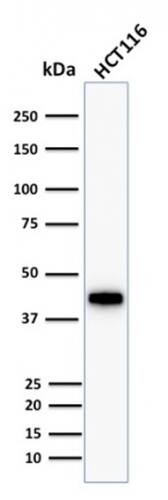 Cytokeratin 18 Antibody (KRT18/1190) - IHC-Prediluted Western Blot: Cytokeratin 18 Antibody (KRT18/1190) - IHC-Prediluted [NBP2-48048] -