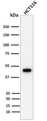 Cytokeratin 18 Antibody (DE-K18) - IHC-Prediluted Western Blot: Cytokeratin 18 Antibody (DE-K18) - IHC-Prediluted [NBP2-48055] -