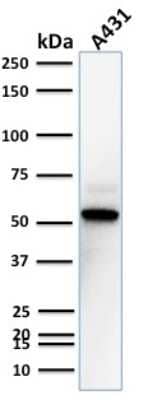 TOX3 Antibody (TOX3/1123) - IHC-Prediluted Western Blot: TOX3 Antibody (TOX3/1123) - IHC-Prediluted [NBP2-48059] -