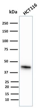Cytokeratin 18 Antibody (KRT18/836) - IHC-Prediluted Western Blot: Cytokeratin 18 Antibody (KRT18/836) - IHC-Prediluted [NBP2-48066] -