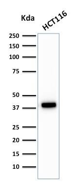 Cytokeratin 18 Antibody (C-04 (same as Ks18.04)) - IHC-Prediluted Western Blot: Cytokeratin 18 Antibody (C-04 (same as Ks18.04)) - IHC-Prediluted [NBP2-48075] -